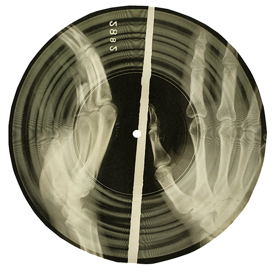 circular xray with handprints and grooves of record